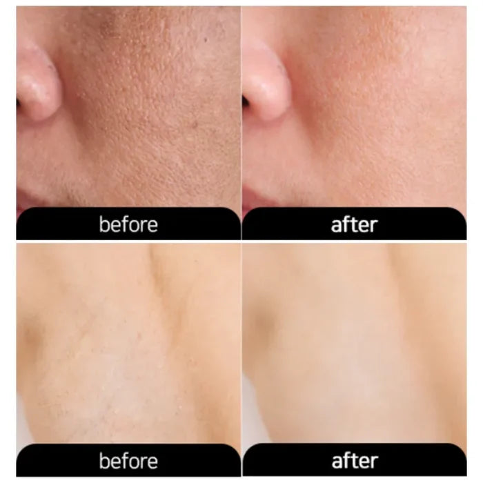 3W CLINIC - Dr.K Underarm Whitening Multi Cream