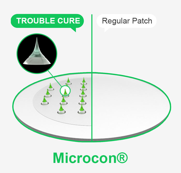 ACROPASS - Trouble Cure
