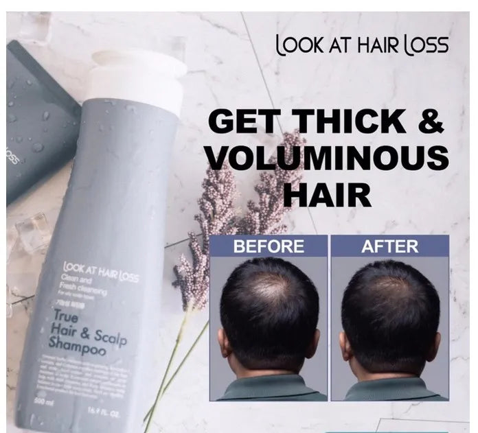 DAENG GI MEO RI - Look At Hair Loss True Hair & Scalp Shampoo
