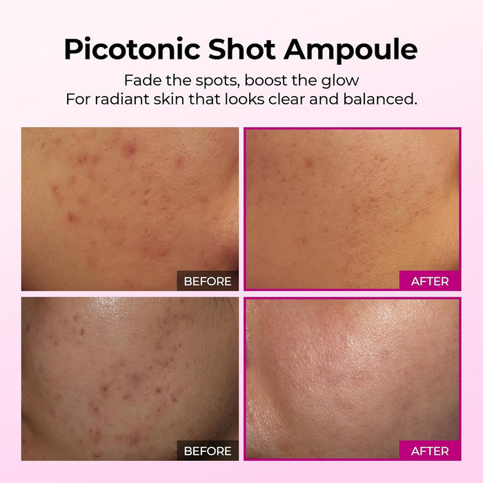 DR. MELAXIN - Cemenrete Picotonic Shot Pigmentation Serum