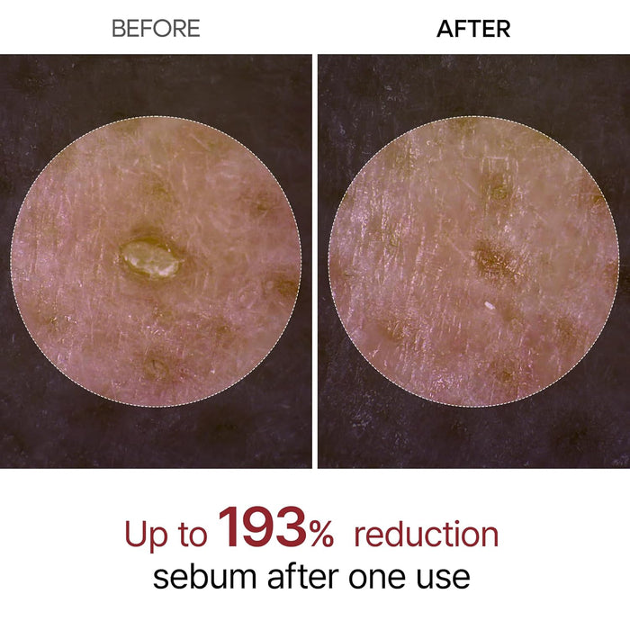 DR. MELAXIN - Peel Shot Exfoliating Black Rice Ampoule