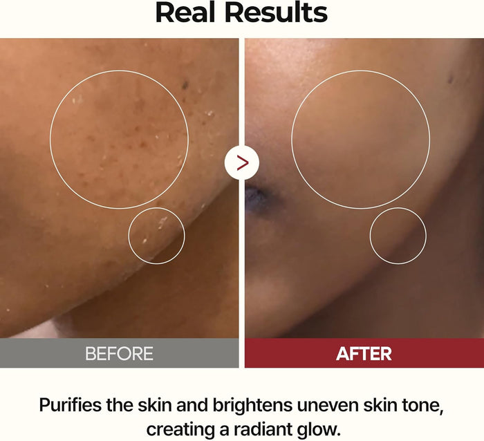 DR. MELAXIN - Peel Shot Glow White Rice Toner