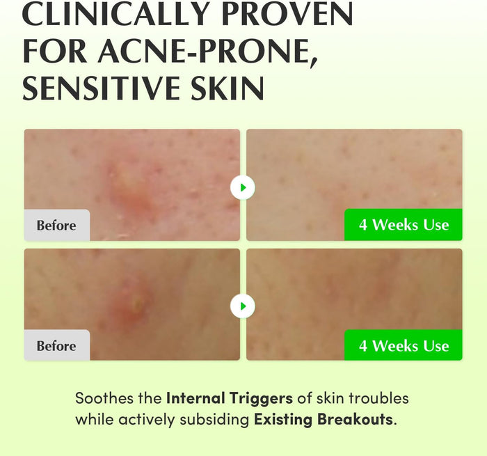EQQUALBERRY - Aloe PDRN Calming Toner