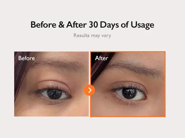 GENABELLE - PDRN 360 Rejuvenating Eye Mask