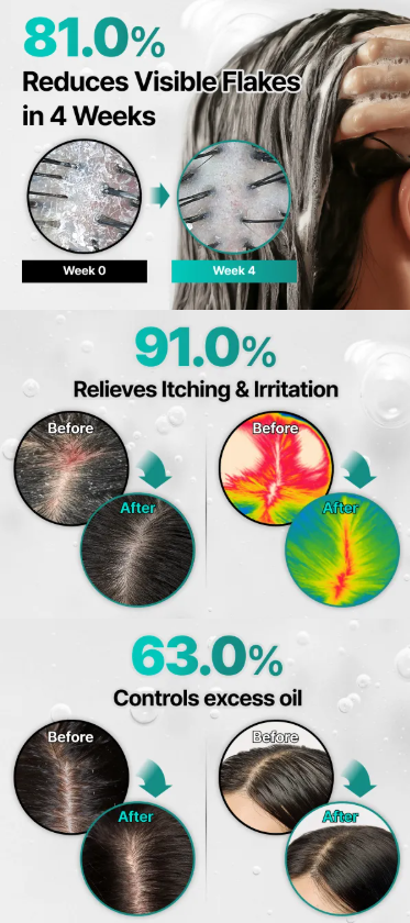 LILYEVE - Scalp Turn Cica PDRN Deep Clean Shampoo