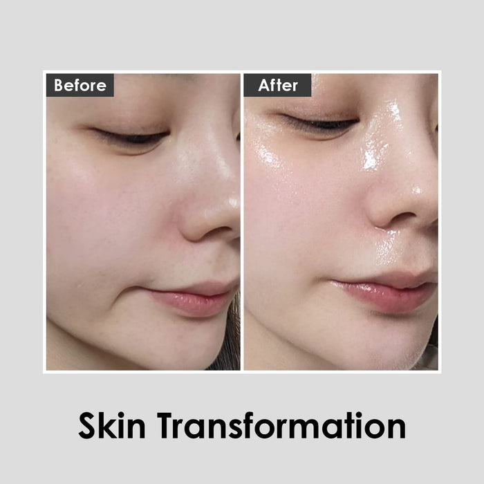 MEDI-PEEL - Red Lacto First Collagen Essence