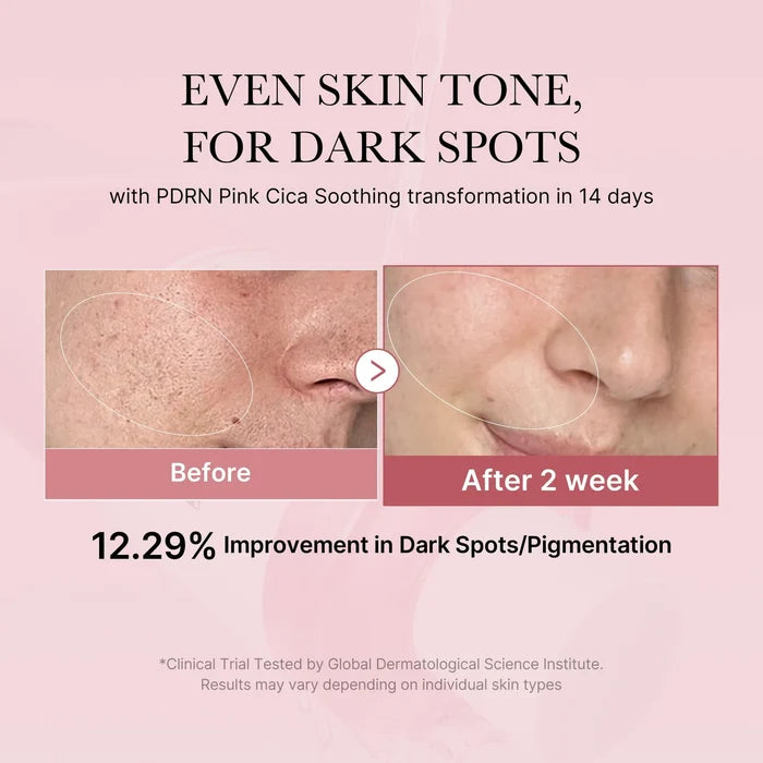 MEDICUBE - PDRN Pink Cica Soothing Toner