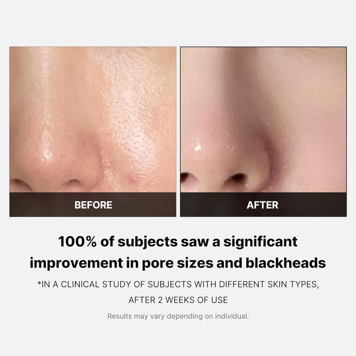 MEDICUBE - Zero Pore Pad 2.0