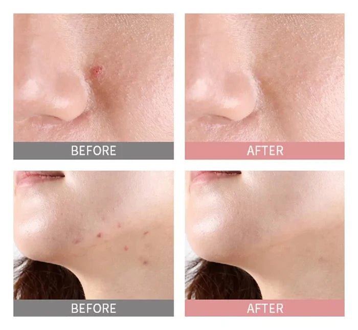 MIZON - Good Bye Blemish Pink Spot