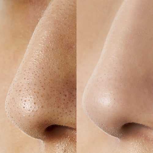 NUMBUZIN - No. 1 Blackhead Soak Off Cleaner