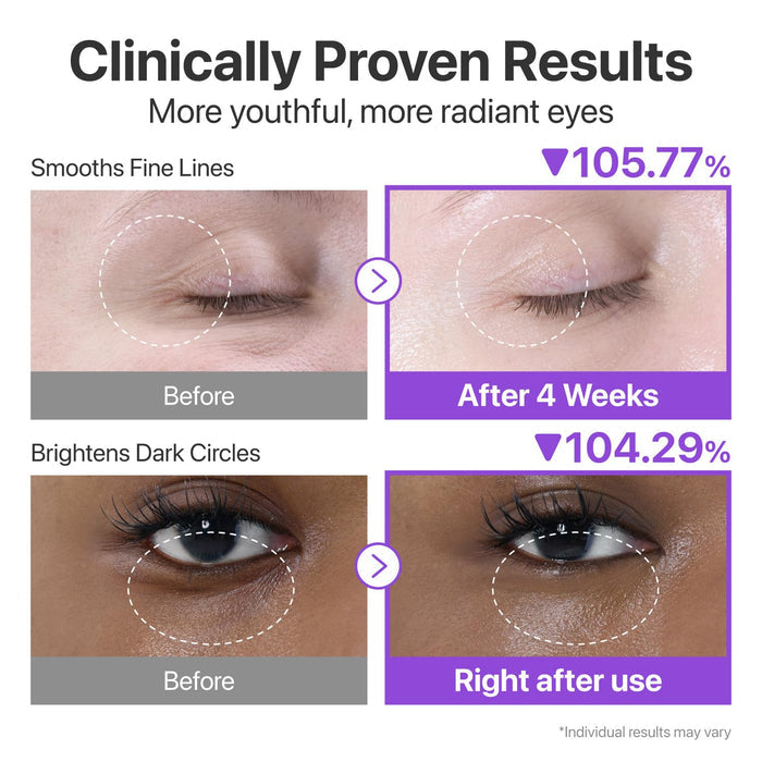 NUMBUZIN - No.9 NAD Retinol Volumetox Eye Cream