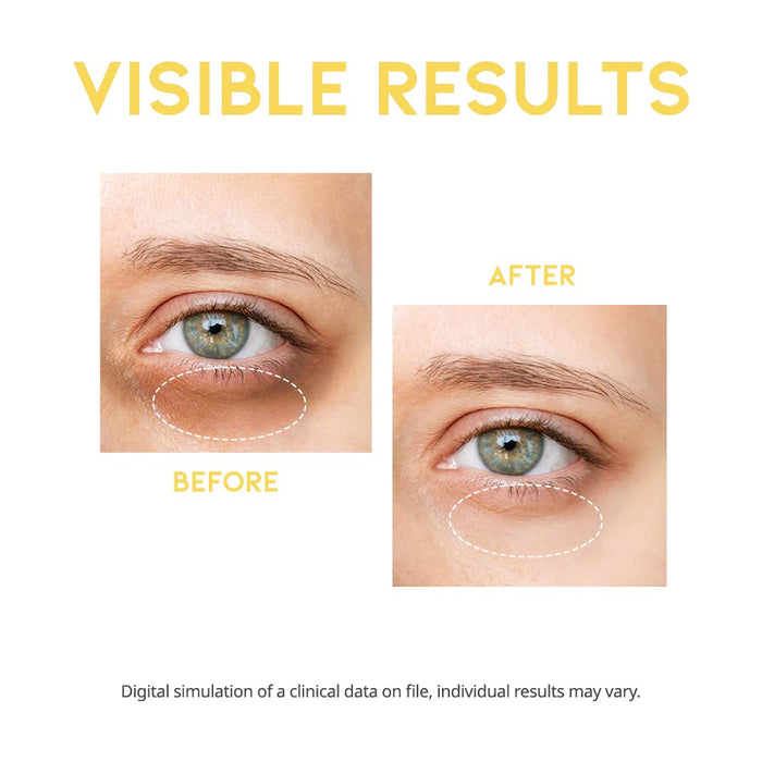 #OOTD - Dark Circle Eye Serum