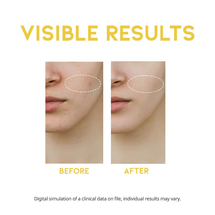 #OOTD - Dark Spot Vitamin C Serum