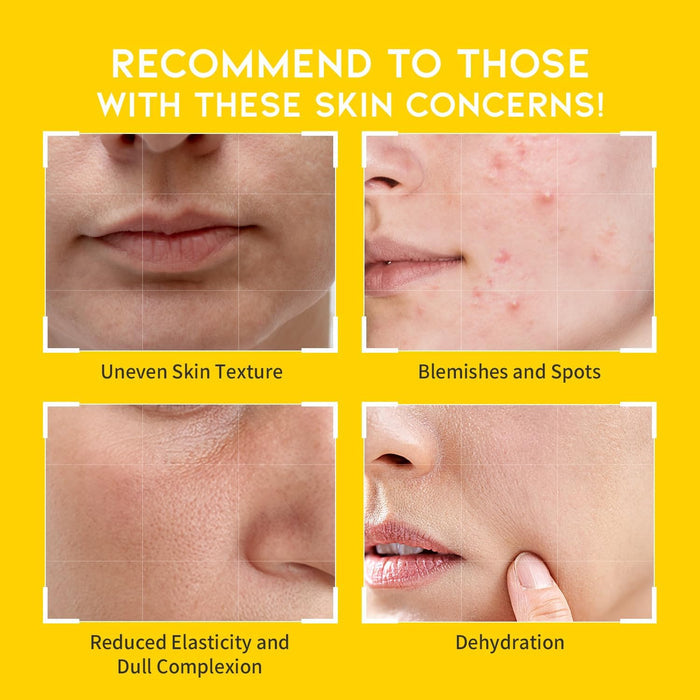 #OOTD - Dark Spot Vitamin C Toner Pad