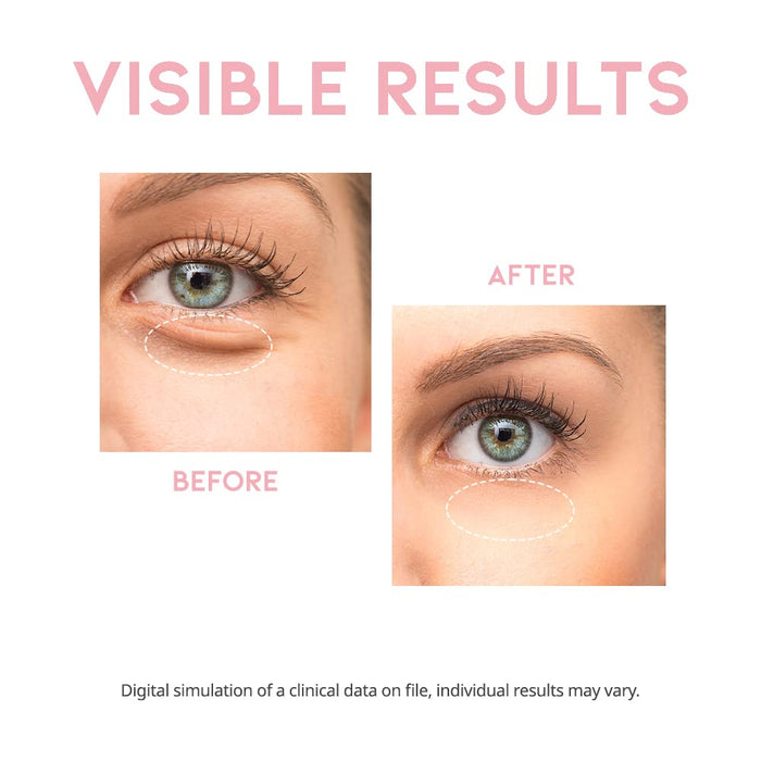 #OOTD - Depuff Eye Serum