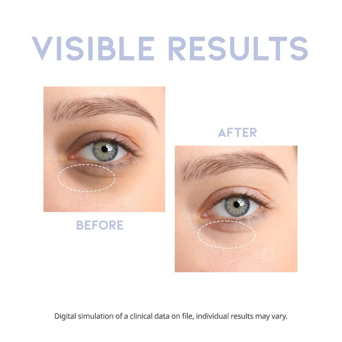 #OOTD - Intensive Eye Serum
