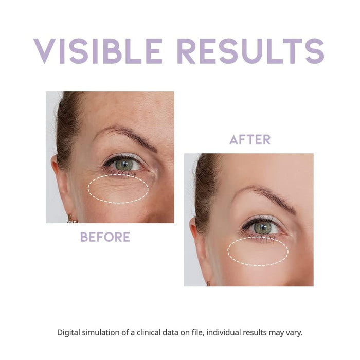 #OOTD - Overnight Eye Cream