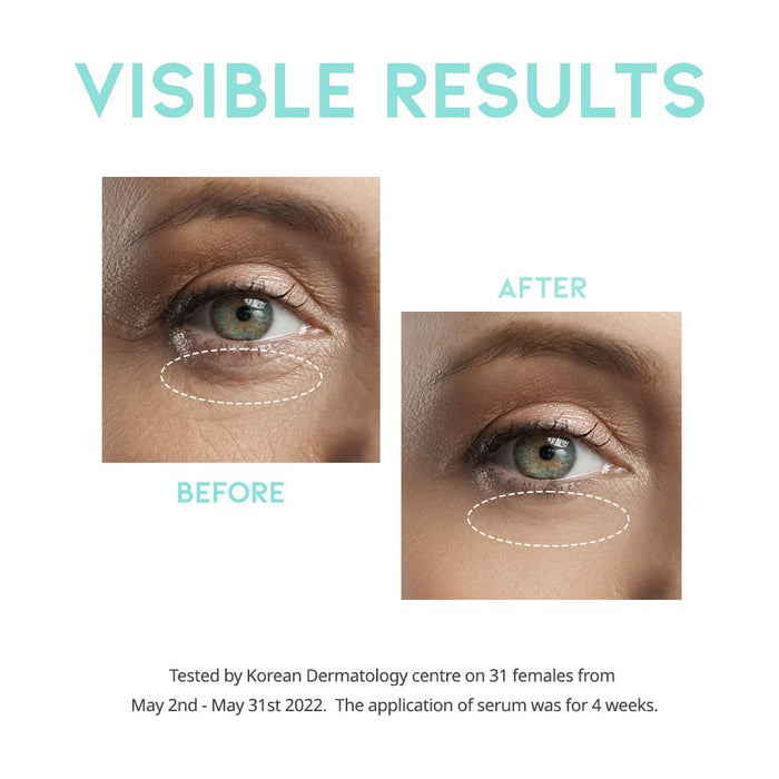 #OOTD - Wrinkle Lift Eye Serum