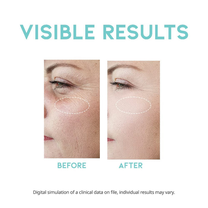 #OOTD - Wrinkle Lift Retinol Serum