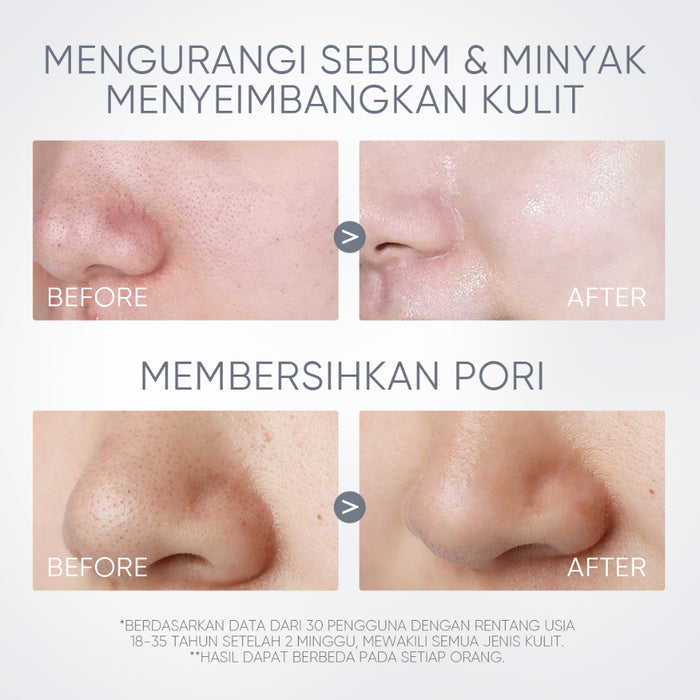 SKINTIFIC - Alaska Volcano Pore Clay Stick