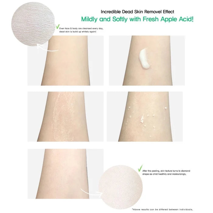 THE ORCHID SKIN - Orchid Flower Apple Soft Peeling Gel