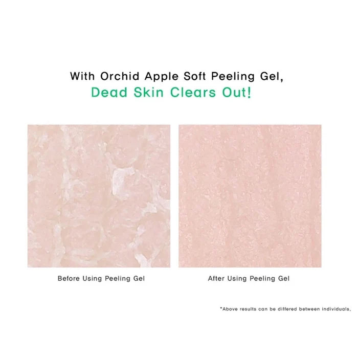 THE ORCHID SKIN - Orchid Flower Apple Soft Peeling Gel